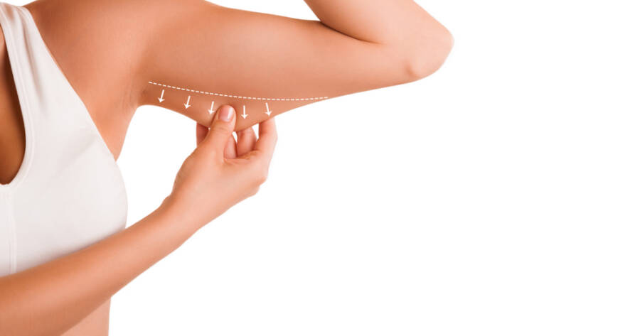 Everything You Need to Know About Tightening Underarm Skin